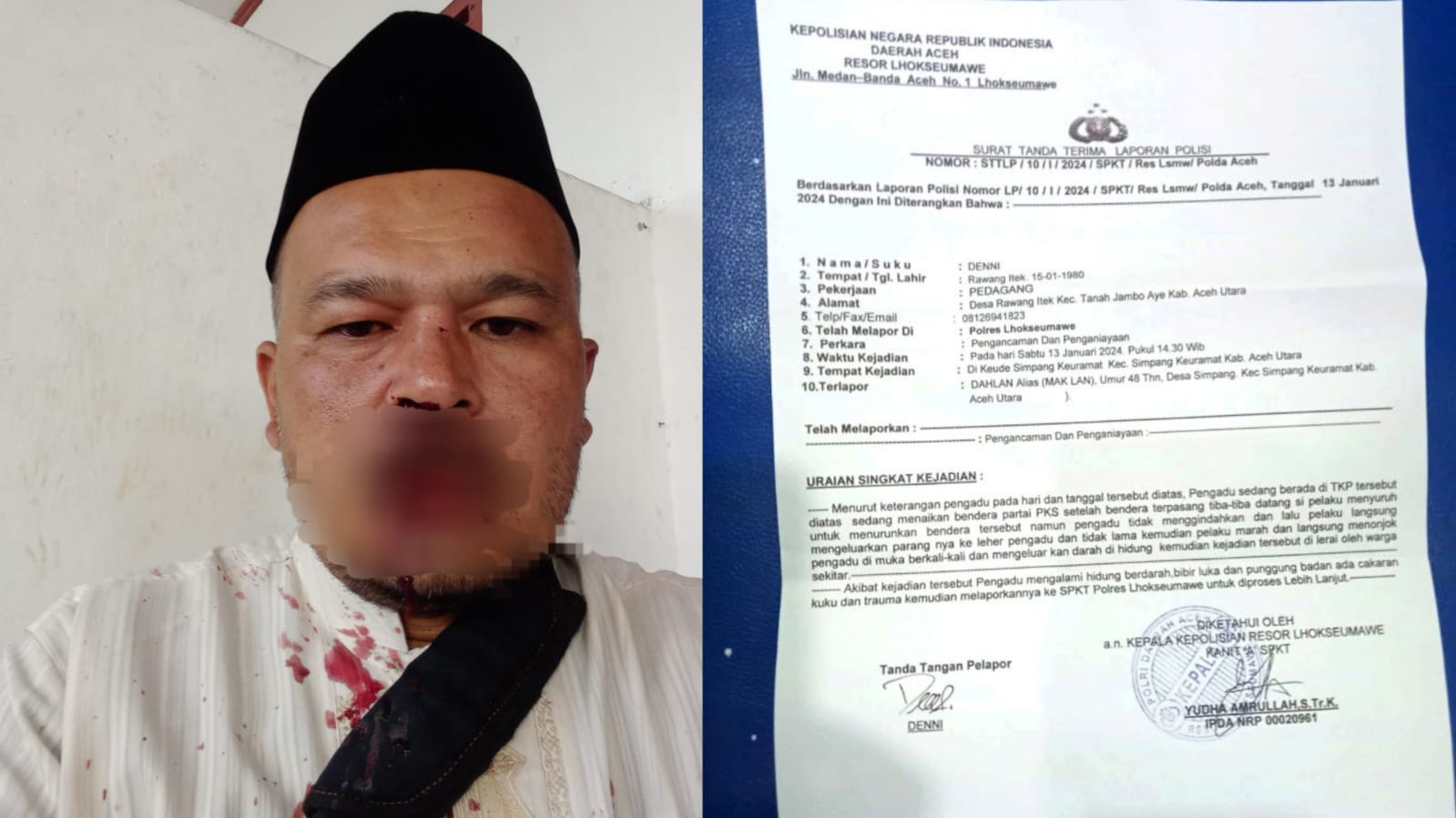 Caleg PKS DPRK Aceh Utara dianiaya hingga berdarah oleh oknum Ketua KONI Aceh Utara
