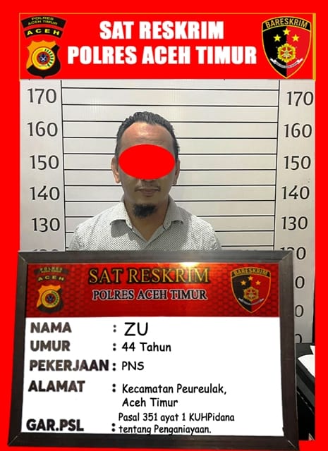 Tersangka ZU diamankan di Polres Aceh Timur terkait kasus penganiayaan terhadap istrinya. (Foto: Dok. Polres Aceh Timur)