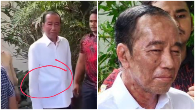 Jokowi Rayakan Ulang Tahun Ke-64, Kondisi Wajahnya Jadi Sorotan