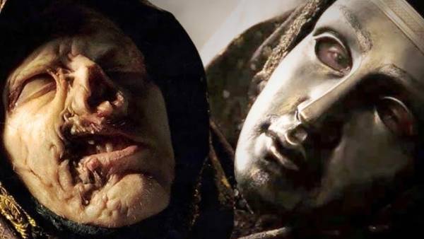 Kesepian hingga Akhir Hayatnya, Ini Penyebab Kenapa Wajah Raja Baldwin Rusak