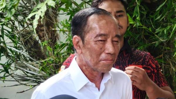 Ultah ke-64, Jokowi Gelar Tasyakuran Sederhana di Solo Meski Wajah Masih Berbintik