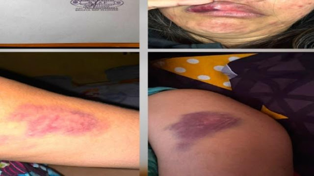 Tak Terima Digerebek Ngamar Bareng Pelakor, Polisi di Sulawesi Utara Hajar Istri