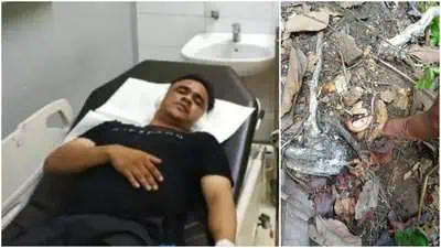 Muhammad Yudhi (36), warga Gampong Lamteh, Kecamatan Ulee Kareng, Banda Aceh terpaksa kehilangan kedua daun telinganya usai dianiaya oleh dua pria, Minggu subuh (12/5/2024). (Foto: Dok Polresta Banda Aceh)