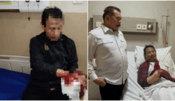 Pegawai Kejaksaan Dibacok OTK Saat Pulang ke Rumah, Urat Tangan Putus
